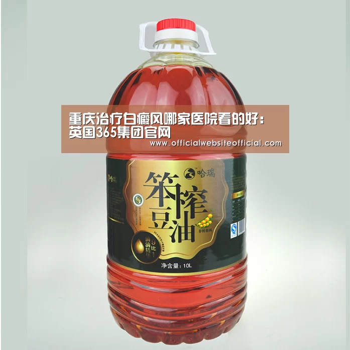重庆治疗白癜风哪家医院看的好:英国365集团官网(图3) 英国365集团