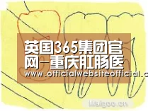 英国365集团官网-重庆肛肠医院如何选择?(图2) 英国365集团直播